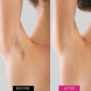 BBOJI™ BeeSilk Hair Removal Mousse (⏰Limited time discount last 30 minutes⏰)