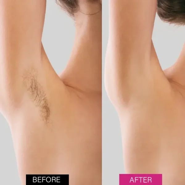 BBOJI™ BeeSilk Hair Removal Mousse (⏰Limited time discount last 30 minutes⏰)