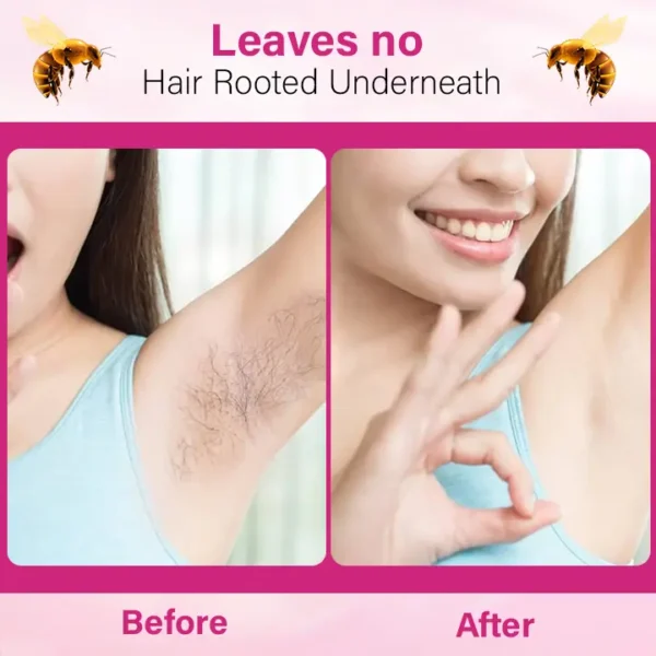 BBOJI™ BeeSilk Hair Removal Mousse (⏰Limited time discount last 30 minutes⏰)