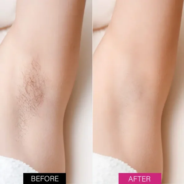 BBOJI™ BeeSilk Hair Removal Mousse (⏰Limited time discount last 30 minutes⏰)