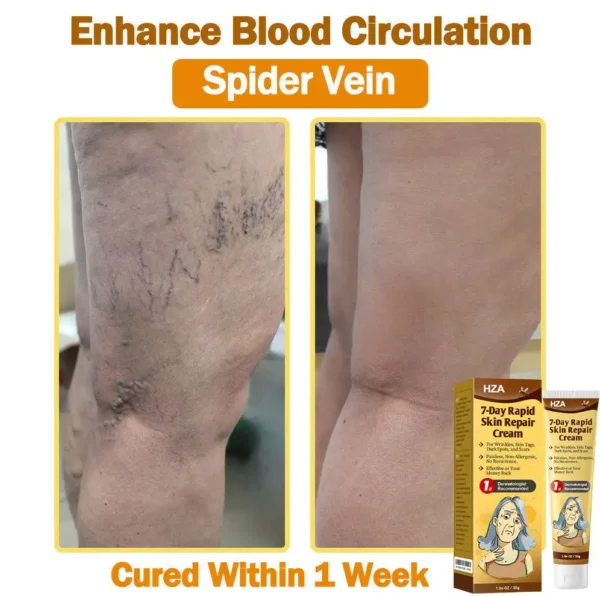 HZA𝟕-𝐃𝐚𝐲 𝐑𝐚𝐩𝐢𝐝 𝐒𝐤𝐢𝐧 𝐑𝐞𝐩𝐚𝐢𝐫 𝐂𝐫𝐞𝐚𝐦 𝐔𝐊 𝐃𝐞𝐫𝐦𝐚𝐭𝐨𝐥𝐨𝐠𝐢𝐬𝐭 𝐀𝐩𝐩𝐫𝐨𝐯𝐞𝐝 (💎💎𝐁𝐀𝐃 𝐑𝐄𝐂𝐎𝐌𝐌𝐄𝐍𝐃𝐄𝐃)
