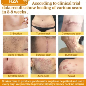 HZA𝟕-𝐃𝐚𝐲 𝐑𝐚𝐩𝐢𝐝 𝐒𝐤𝐢𝐧 𝐑𝐞𝐩𝐚𝐢𝐫 𝐂𝐫𝐞𝐚𝐦 𝐔𝐊 𝐃𝐞𝐫𝐦𝐚𝐭𝐨𝐥𝐨𝐠𝐢𝐬𝐭 𝐀𝐩𝐩𝐫𝐨𝐯𝐞𝐝 (💎💎𝐁𝐀𝐃 𝐑𝐄𝐂𝐎𝐌𝐌𝐄𝐍𝐃𝐄𝐃)