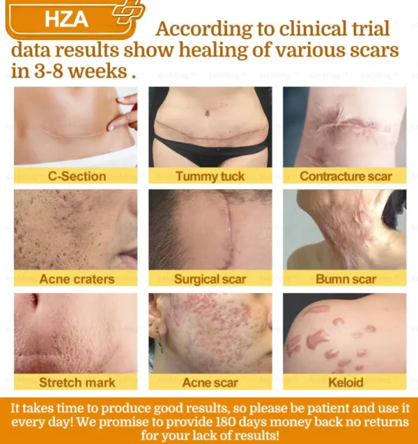 HZA𝟕-𝐃𝐚𝐲 𝐑𝐚𝐩𝐢𝐝 𝐒𝐤𝐢𝐧 𝐑𝐞𝐩𝐚𝐢𝐫 𝐂𝐫𝐞𝐚𝐦 𝐔𝐊 𝐃𝐞𝐫𝐦𝐚𝐭𝐨𝐥𝐨𝐠𝐢𝐬𝐭 𝐀𝐩𝐩𝐫𝐨𝐯𝐞𝐝 (💎💎𝐁𝐀𝐃 𝐑𝐄𝐂𝐎𝐌𝐌𝐄𝐍𝐃𝐄𝐃)