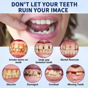 SmileFitPro™ New Generation Flexible Full Denture Solution