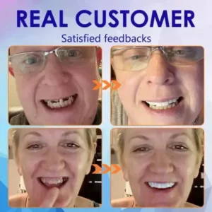 SmileFitPro™ New Generation Flexible Full Denture Solution