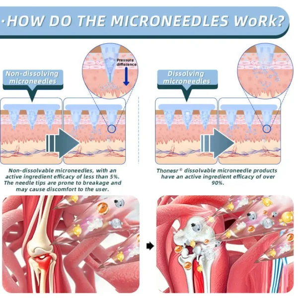 Thonesr® Nano-microneedle joint patch