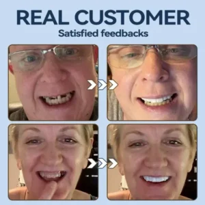 SmileFitPro® – MedicalFit Adaptive Dentures – Suitable for all mouth shapes, perfect fit