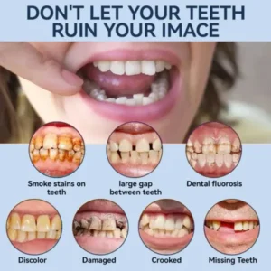SmileFitPro® – MedicalFit Adaptive Dentures – Suitable for all mouth shapes, perfect fit