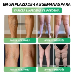 𝐁𝐮𝐢𝐥𝐝𝐋𝐞𝐚𝐟® 𝑮𝑳𝑷-1 𝐅𝐢𝐭 & 𝐕𝐢𝐭𝐚𝐥 8 en 1 𝐒𝐨𝐥𝐮𝐜𝐢ó𝐧 𝐎𝐫𝐚𝐥🥇 (Solo una vez al día, cambios visibles en 7 días) Para obesidad, salud cardiovascular, diabetes, apnea del sueño, salud intestinal, problemas articulares y más（副本）