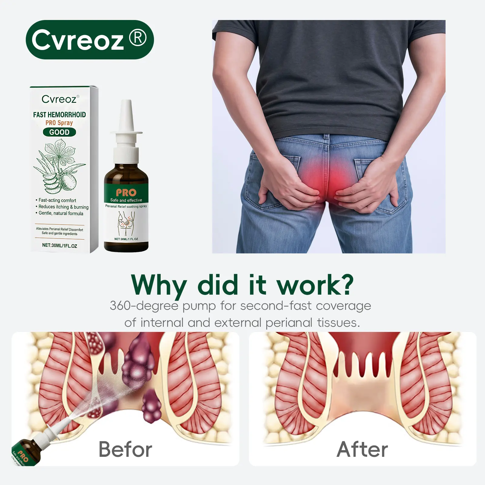 Cvreoz® Fast Hemorrhoid PRO Spray