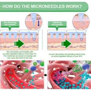 【Last Day Promotion 60% OFF】💕NESLEMY®Tirzepatide Slimming & health NANO MICRONEEDLE PATCH👑（Zero Pain, 24/7 Release | Lose 9 kg FAST | 90% Sugar Drop | ）💕