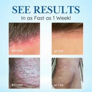 ✨Limited-Time 50% OFF Deal |  Get Calm & Comfort for Less | Cvreoz® Source-Relief Magnesium Spray