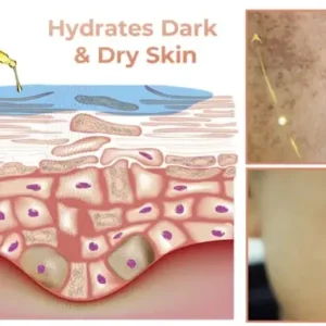 NESLEMY™ Fast Dark Spot Remover