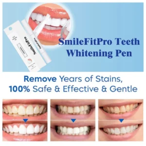SmileFitPro™