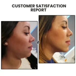 🎁 NESLEMY™ Limited-Time Offer: 60% Off! 🌲Lymphatic Magnetic Therapy Germanium Earrings 😍