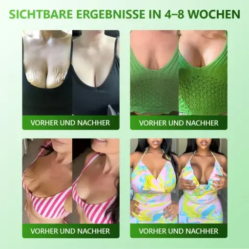 Cvreoz® 𝗬𝗼𝘂𝐭𝐡𝐆𝗹𝗼𝘄 𝑺𝒕𝙖𝙢𝙢𝙯𝙚𝒍𝒍𝒆𝒏 𝙆𝙤𝒍𝒍𝒂𝙜𝙚𝒏 𝗧𝗿𝗼𝒑𝐟𝙚𝙣