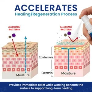 Cvreoz® Genital Treatment Spray