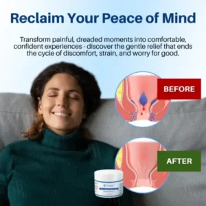 Cvreoz® Hemorrhoid & Fissure Cream