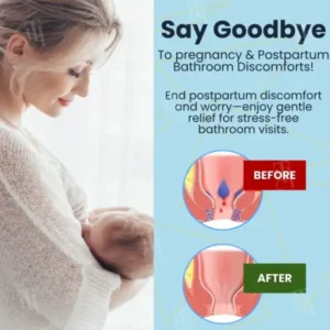 Cvreoz® Herbal Hemorrhoid Treatment Anal Spray + Wipes