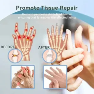 Cvreoz® Nerve Repair &Pain Relief Magnesium Cream