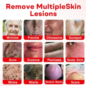 Cvreoz®MicroNeedle BotanicSkin Tag Removal Patch