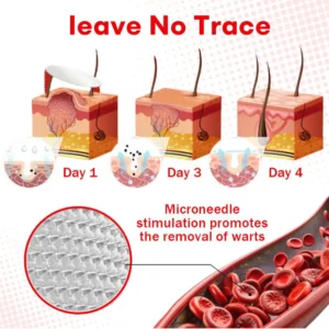 Cvreoz®MicroNeedle BotanicSkin Tag Removal Patch