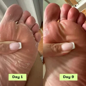 NESLEMY® AntiFungal Relief Soap Bar