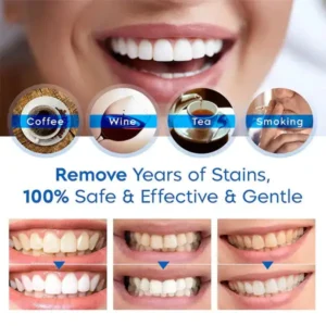SmileFitPro™ Teeth Whitening Essence
